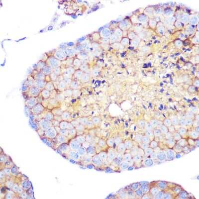 Immunohistochemistry-Paraffin: Integrin alpha 4/CD49d Antibody (8M8C2) [NBP3-16322]