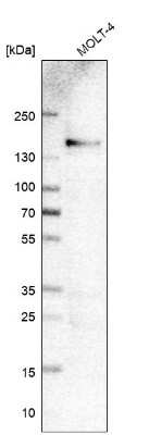 Western Blot: Integrin alpha 4/CD49d Antibody (CL11294) [NBP3-07999]