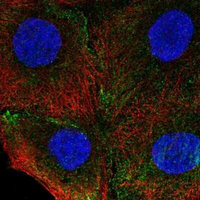 Immunocytochemistry/ Immunofluorescence: Integrin alpha 4/CD49d Antibody [NBP2-68992]