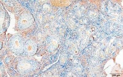 Immunohistochemistry-Paraffin: Integrin alpha 4/CD49d Antibody (PS/2) - Azide and BSA Free [NBP1-26661]