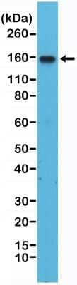 Western Blot: Integrin alpha 4/CD49d Antibody (RM268) [NBP2-61560]