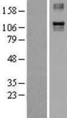 Western Blot: Integrin alpha 4/CD49d Overexpression Lysate [NBL1-12064]