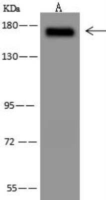 Western Blot: Integrin alpha 4 beta 7/LPAM-1 Antibody [NBP3-12719]