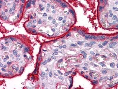 Immunohistochemistry: Integrin alpha 5/CD49e Antibody (10F6) - BSA Free [NBP2-37666]