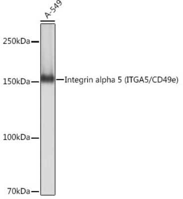 Western Blot: Integrin alpha 5/CD49e Antibody (8F2O6) [NBP3-15645]