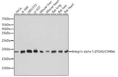 Western Blot: Integrin alpha 5/CD49e Antibody (8F2O6) [NBP3-15645]