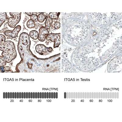 Immunohistochemistry-Paraffin: Integrin alpha 5/CD49e Antibody (CL6940) [NBP2-76518]
