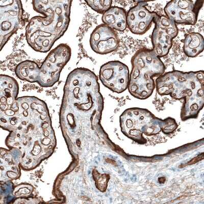 Immunohistochemistry-Paraffin: Integrin alpha 5/CD49e Antibody (CL6940) [NBP2-76518]
