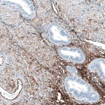 Immunohistochemistry-Paraffin: Integrin alpha 5/CD49e Antibody (CL6940) [NBP2-76518]