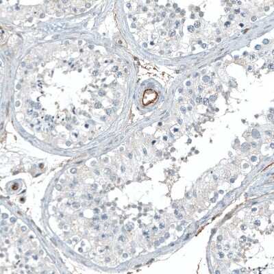 Immunohistochemistry-Paraffin: Integrin alpha 5/CD49e Antibody (CL6940) [NBP2-76518]