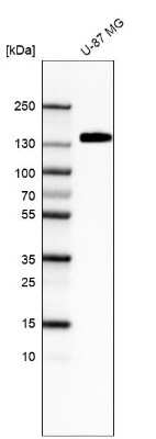 Western Blot: Integrin alpha 5/CD49e Antibody (CL6940) [NBP2-76518]