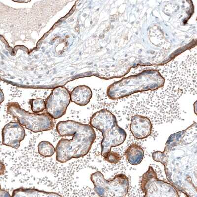 Immunohistochemistry-Paraffin: Integrin alpha 5/CD49e Antibody (CL6945) [NBP2-76519]