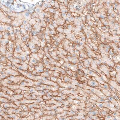 Immunohistochemistry-Paraffin: Integrin alpha 5/CD49e Antibody (CL6945) [NBP2-76519]