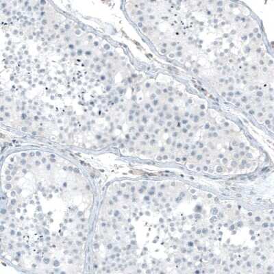 Immunohistochemistry-Paraffin: Integrin alpha 5/CD49e Antibody (CL6945) [NBP2-76519]