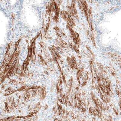 Immunohistochemistry-Paraffin: Integrin alpha 5/CD49e Antibody (CL6945) [NBP2-76519]