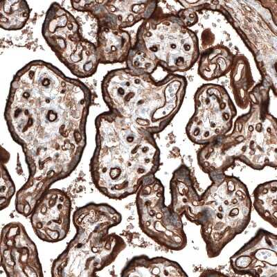 Immunohistochemistry-Paraffin: Integrin alpha 5/CD49e Antibody (CL6951) [NBP2-76520]