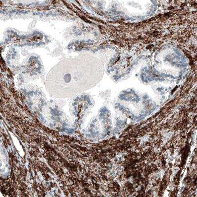 Immunohistochemistry-Paraffin: Integrin alpha 5/CD49e Antibody (CL6951) [NBP2-76520]