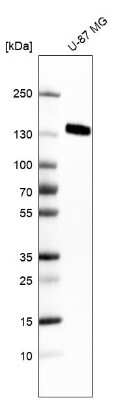 Western Blot: Integrin alpha 5/CD49e Antibody (CL6951) [NBP2-76520]
