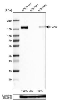 Western Blot: Integrin alpha 5/CD49e Antibody (CL6951) [NBP2-76520]