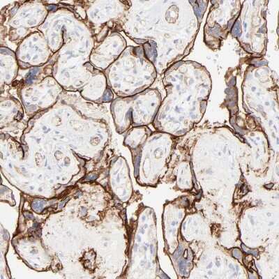 Immunohistochemistry-Paraffin: Integrin alpha 5/CD49e Antibody [NBP1-84576]