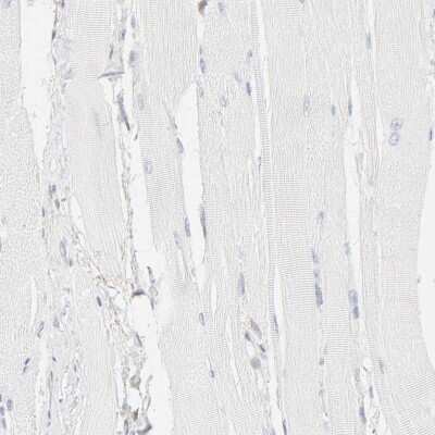 Immunohistochemistry-Paraffin: Integrin alpha 5/CD49e Antibody [NBP1-84576]