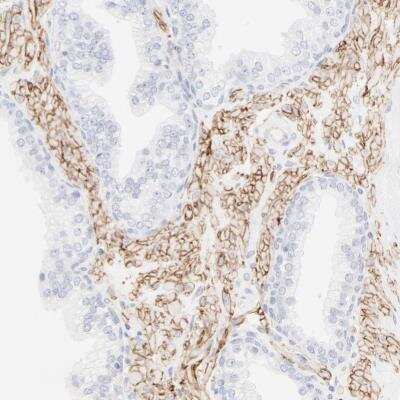 Immunohistochemistry-Paraffin: Integrin alpha 5/CD49e Antibody [NBP1-84576]