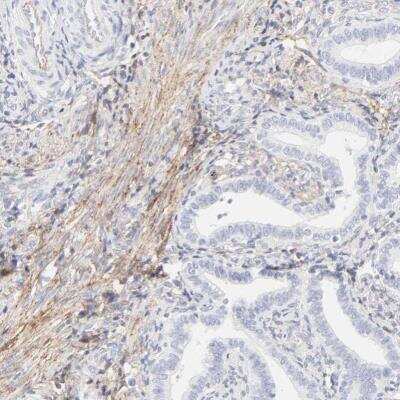 Immunohistochemistry-Paraffin: Integrin alpha 5/CD49e Antibody [NBP1-84576]
