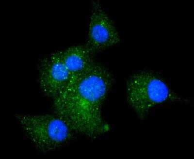 Immunocytochemistry/ Immunofluorescence: Integrin alpha 5/CD49e Antibody (JJ08-94) [NBP2-67883]