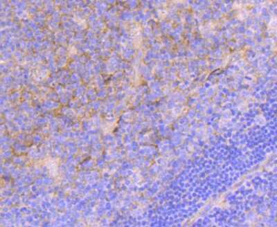 Immunohistochemistry-Paraffin: Integrin alpha 5/CD49e Antibody (JJ08-94) [NBP2-67883]