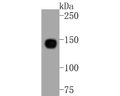 Western Blot: Integrin alpha 5/CD49e Antibody (JJ08-94) [NBP2-67883]