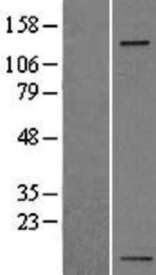 Western Blot: Integrin alpha 5/CD49e Overexpression Lysate [NBL1-12065]