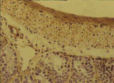 Immunohistochemistry: Integrin alpha 5 beta 1 Antibody (BMC5) [NBP2-29788]