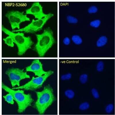 Immunofluorescence: Integrin alpha 5 beta 1 Antibody (M200 (Volociximab)) - Chimeric - Azide and BSA Free [NBP2-52680]