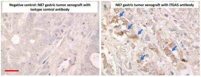 Immunohistochemistry-Paraffin: Integrin alpha 5 beta 1 Antibody (M200 (Volociximab)) - Chimeric - Azide and BSA Free [NBP2-52680]