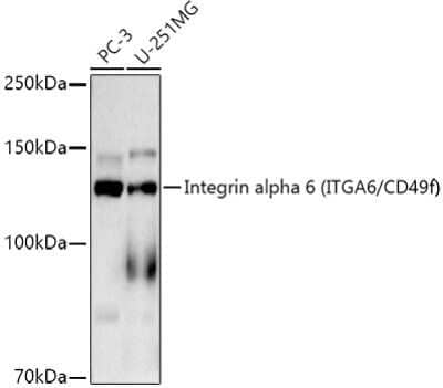 Western Blot: Integrin alpha 6/CD49f Antibody (7U5Z0) [NBP3-16085]