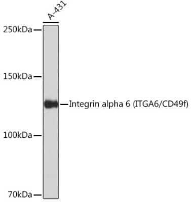 Western Blot: Integrin alpha 6/CD49f Antibody (2R5F1) [NBP3-15646]