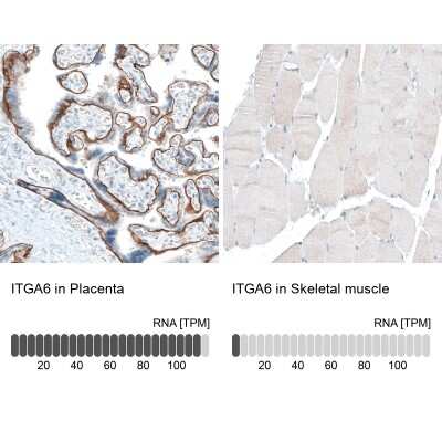 Immunohistochemistry-Paraffin: Integrin alpha 6/CD49f Antibody (CL6957) [NBP2-76523]