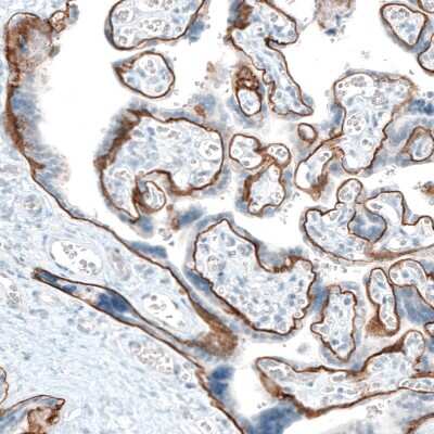 Immunohistochemistry-Paraffin: Integrin alpha 6/CD49f Antibody (CL6957) [NBP2-76523]