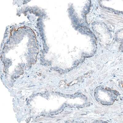 Immunohistochemistry-Paraffin: Integrin alpha 6/CD49f Antibody (CL6957) [NBP2-76523]