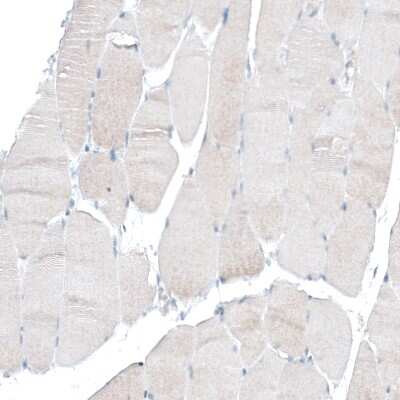 Immunohistochemistry-Paraffin: Integrin alpha 6/CD49f Antibody (CL6957) [NBP2-76523]