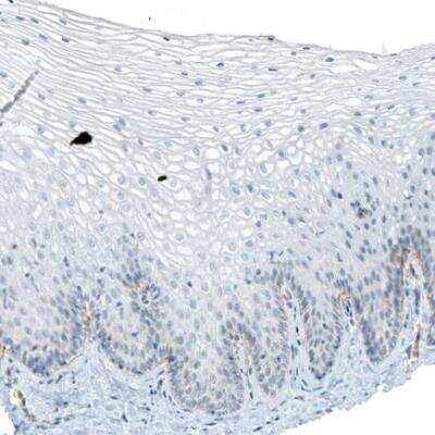 Immunohistochemistry-Paraffin: Integrin alpha 6/CD49f Antibody (CL6957) [NBP2-76523]