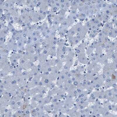 Immunohistochemistry-Paraffin: Integrin alpha 6/CD49f Antibody [NBP1-85747]