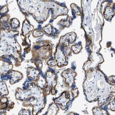 Immunohistochemistry-Paraffin: Integrin alpha 6/CD49f Antibody [NBP1-85747]