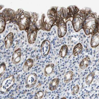 Immunohistochemistry-Paraffin: Integrin alpha 6/CD49f Antibody [NBP1-85747]