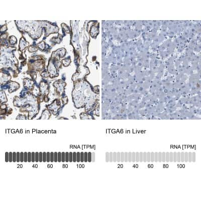 Immunohistochemistry-Paraffin: Integrin alpha 6/CD49f Antibody [NBP1-85747]