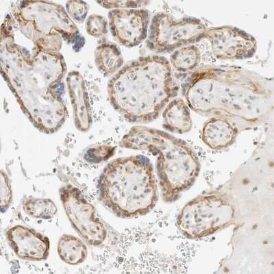 Immunohistochemistry-Paraffin: Integrin alpha 6/CD49f Antibody [NBP1-85748]
