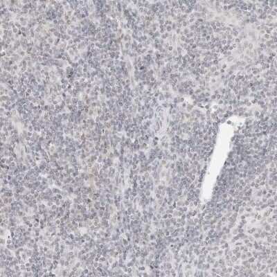 Immunohistochemistry-Paraffin: Integrin alpha 6/CD49f Antibody [NBP1-85748]