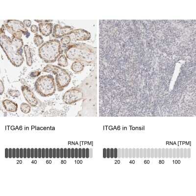 Immunohistochemistry-Paraffin: Integrin alpha 6/CD49f Antibody [NBP1-85748]