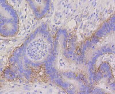 Immunohistochemistry-Paraffin: Integrin alpha 6/CD49f Antibody (SR45-00) [NBP2-67311]