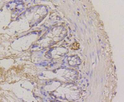 Immunohistochemistry-Paraffin: Integrin alpha 6/CD49f Antibody (SR45-00) [NBP2-67311]